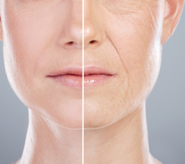 anti-aging treatments